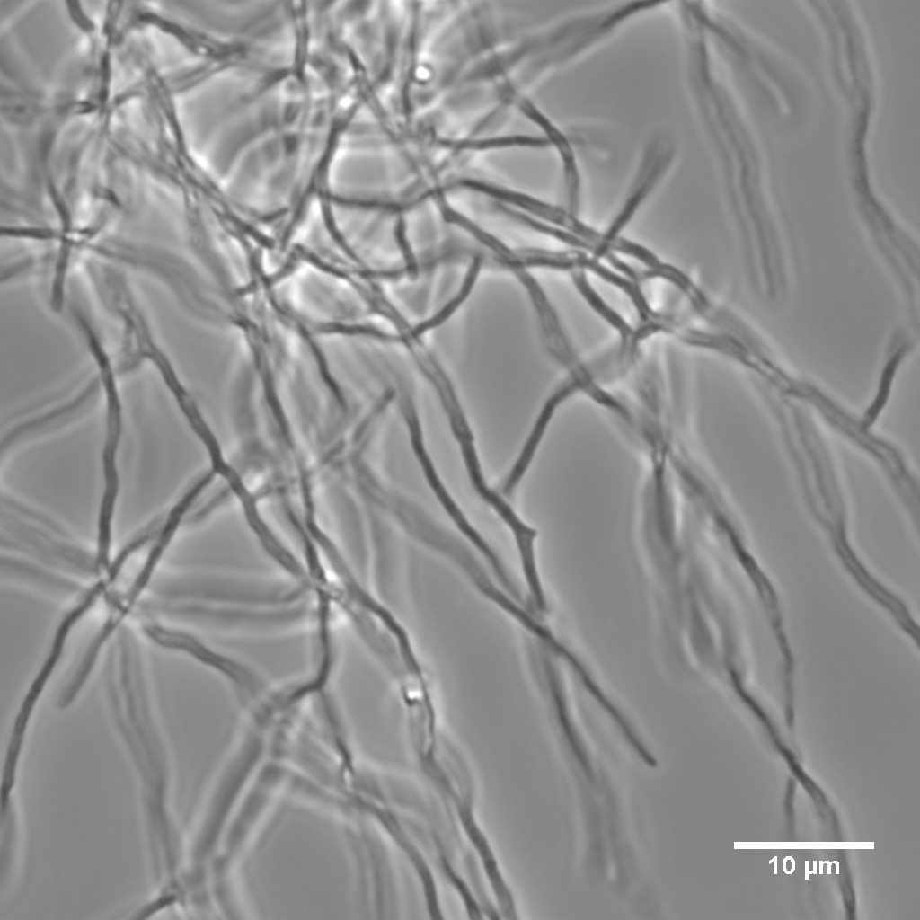 S. bottropensis culture seen from a microscope